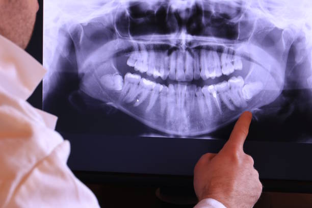 Best Cracked Tooth Emergency Dentist  in Clermont, GA